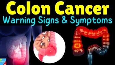 raquel colon cancer symptoms